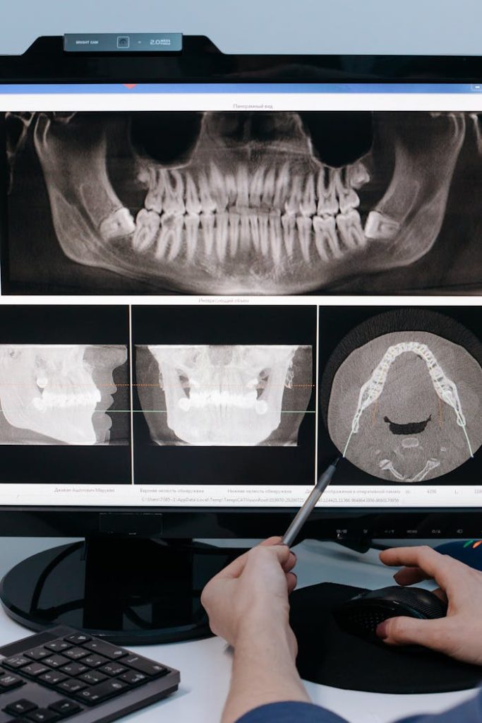 An X-ray Image of a Jawbone in the Computer